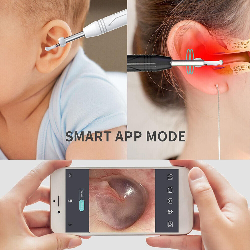 Smart Earpick Ear Wax Removal Cleaner