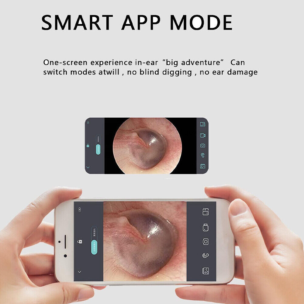 Smart Earpick Ear Wax Removal Cleaner