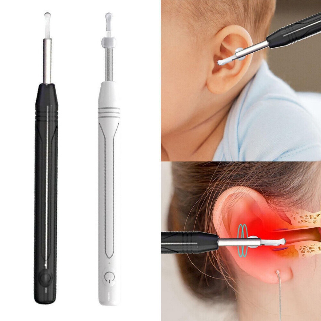 Smart Earpick Ear Wax Removal Cleaner
