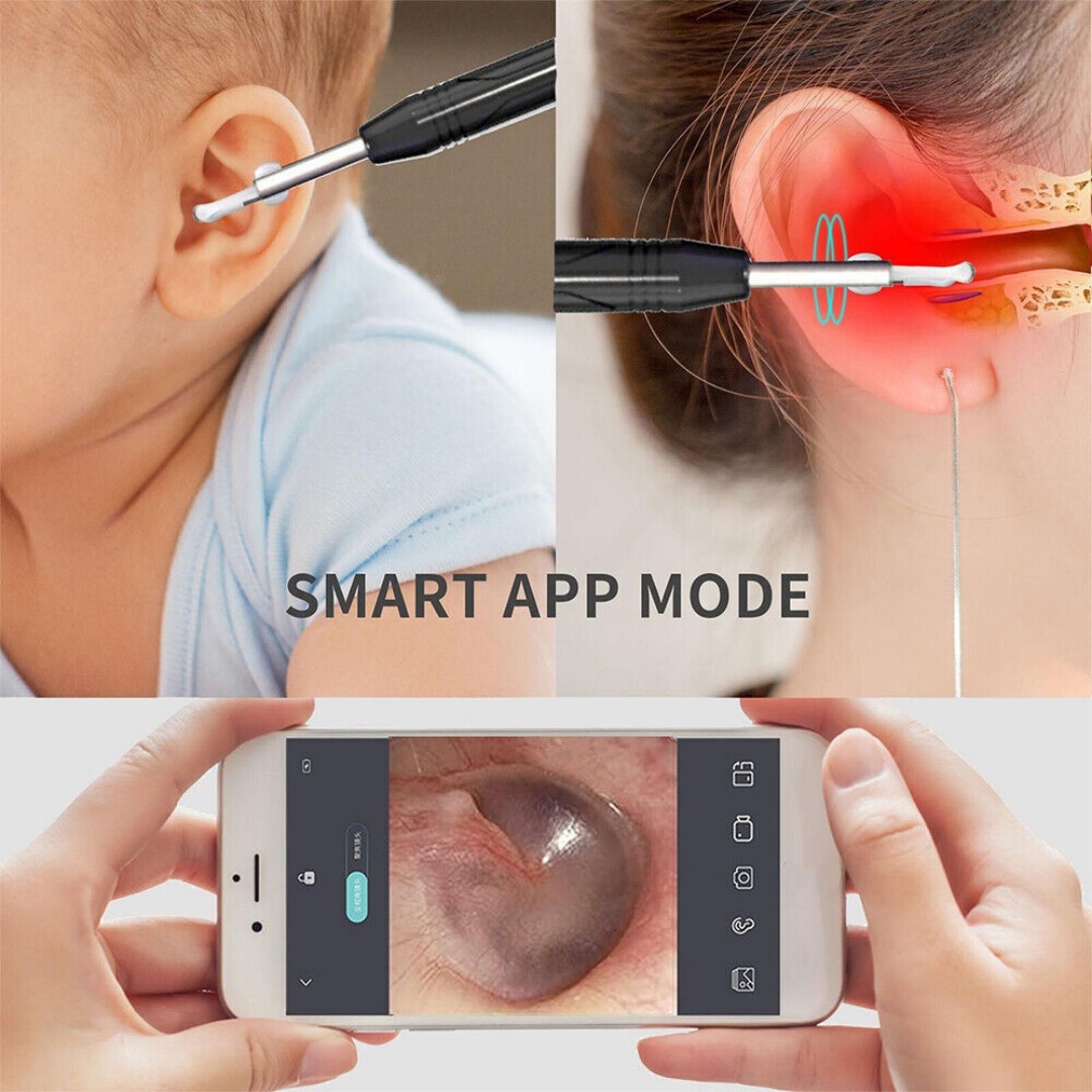 Smart Earpick Ear Wax Removal Cleaner