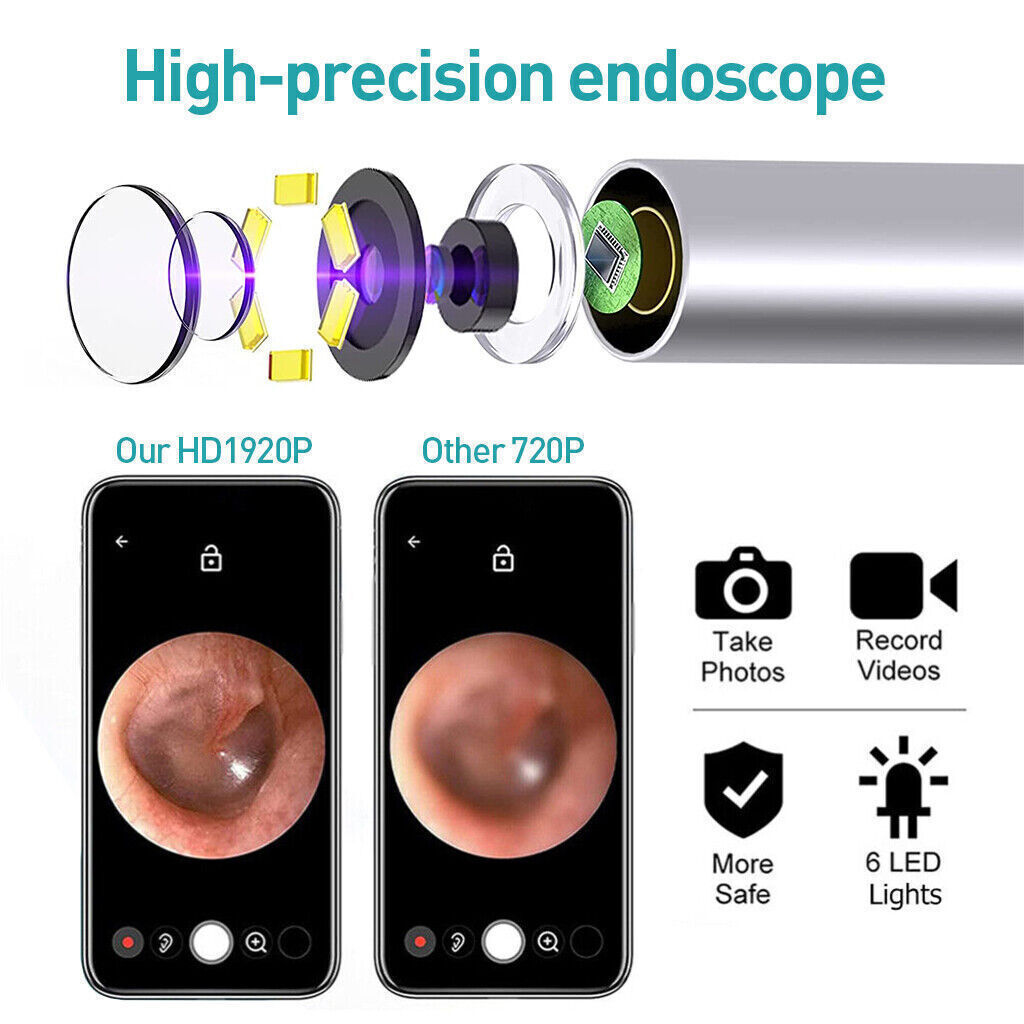 Wireless Earwax Removal Kit